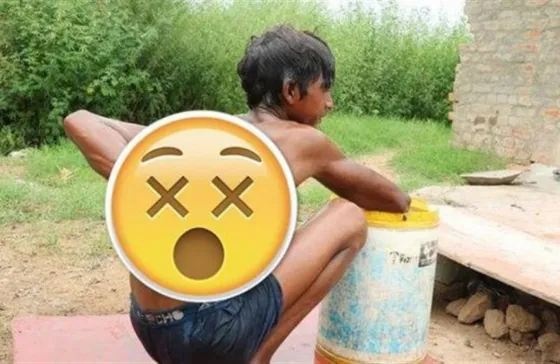 Lo llaman "Diablo" : Tiene 12 años y sus manos no paran de crecer