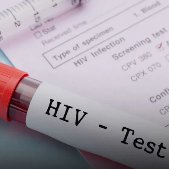 Yrigoyen: Confirmaron tres casos positivos de H.I.V en menos de un mes