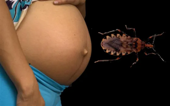 3 de cada 100 mujeres embarazadas tiene Chagas
