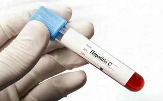 Hepatitis C: "Del 10 al 15% de personas que la contraen pueden resolverla"