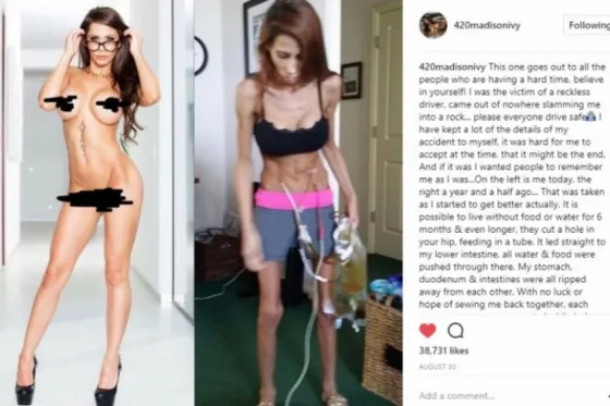 Actriz porno publica fotos antes y después de casi perder la vida