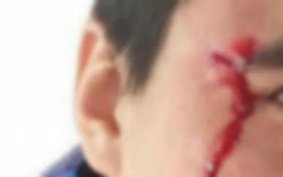 Agredieron a otro chofer de SAETA