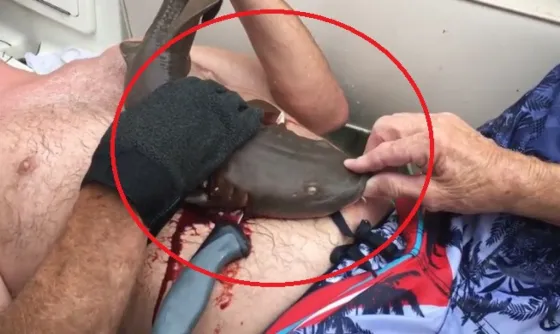 Un mini tiburón muerde a un hombre en el vientre y no lo suelta