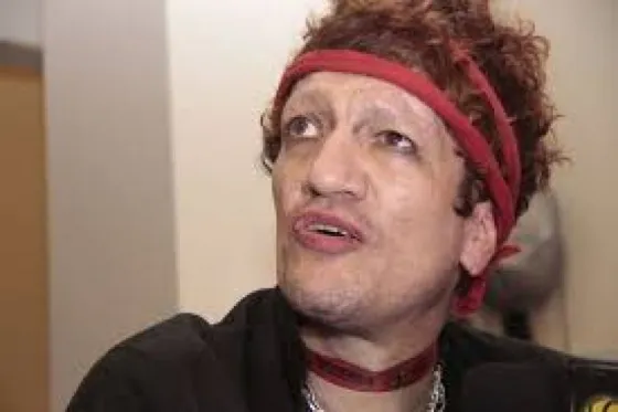 Terrible: Mira las fotos del Pity Álvarez antes de recuperarse