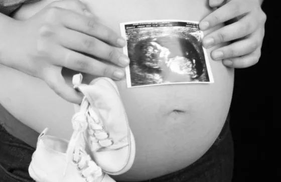 La ecografía de un bebé que se volvió viral por un impensado detalle . Mirá