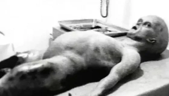 La autopsia alien que conmocionó al mundo