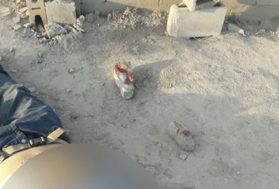 Violencia de Género: Quiso defender a su hermana y ahora está grave