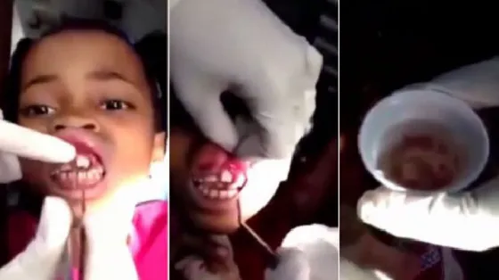 Sentía dolor en sus encías, fue al dentista y ¡mirá que tenía!