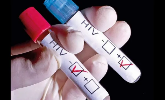 Realizan un test rápido de VIH
