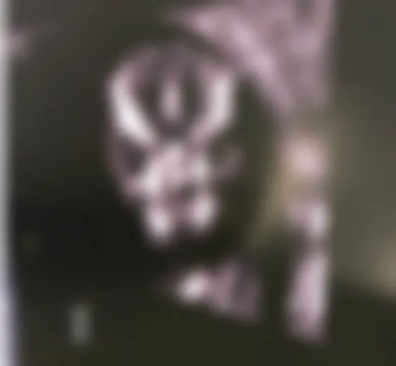 Increíble: Mostraron la ecografía de un feto diabólico