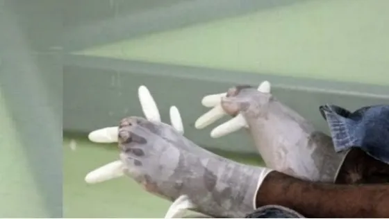 Se accidentó y por su “olor a pata” evacuaron el hospital (Vídeo)