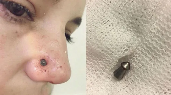 TERRIBLE: Jugaba con sus hijos en la plaza y recibió un disparo en la cara