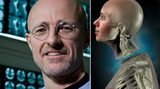 Increíble: Realizaran el Primer trasplante de cabeza antes de fin de año