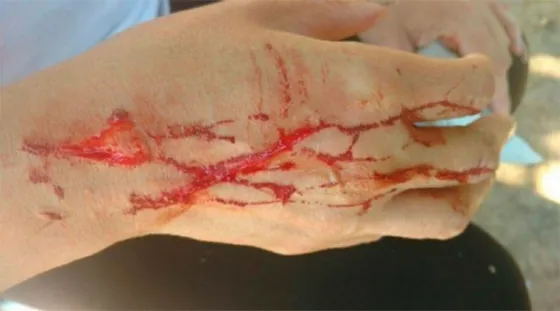 La atacaron salvajemente mientras visitaba la tumba de su mamá