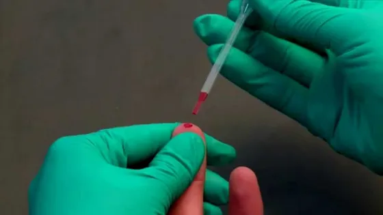 Orán en jaque por los casos de HIV Y SÍFILIS