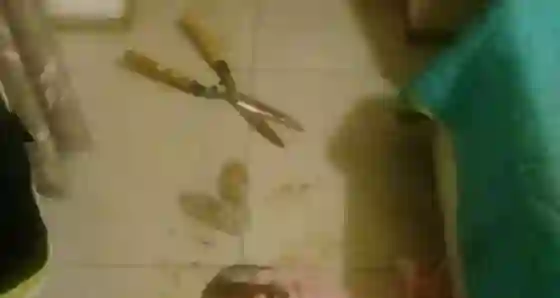 Quedó estéril el hombre al que le cortaron los testículos