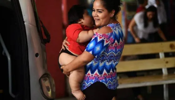 Bebé de 10 meses pesa 30 kilos y es considerado el más obeso del mundo