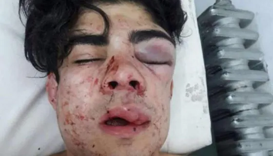 Le destrozaron la cara "por chileno"