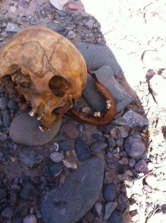 Encontró un cráneo, no lo denunció en la policía sino en las redes