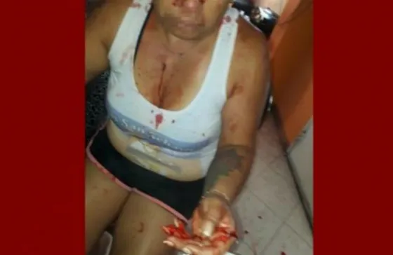 Atacó a cuchillazos a su ex pareja