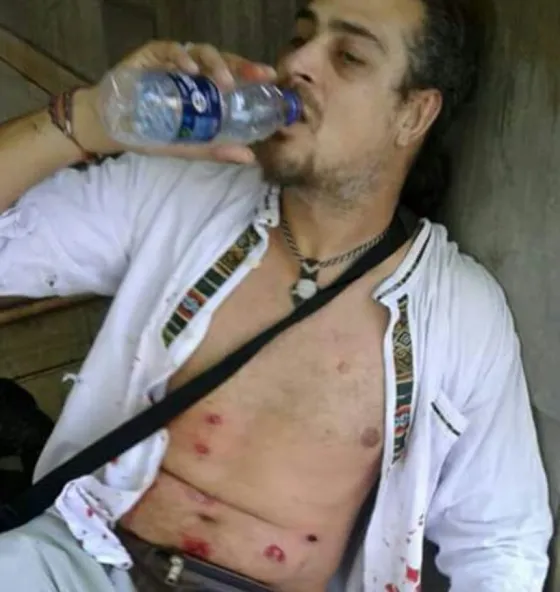 Congreso de la Nación: Un fotógrafo recibió 10 balazos de goma