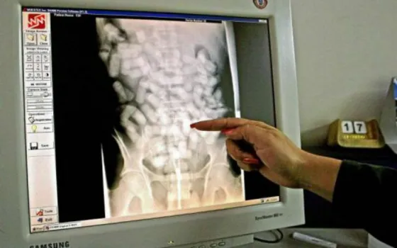 Detuvieron a una mujer que viajaba a Mendoza con cápsulas de cocaína en el estómago