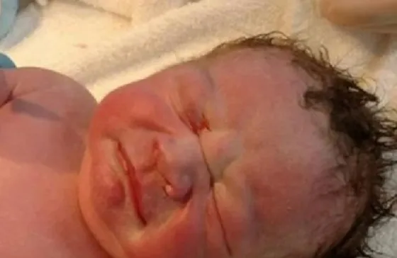 Un bebé nació con el DIU entre sus manos ¡Mirá la foto!