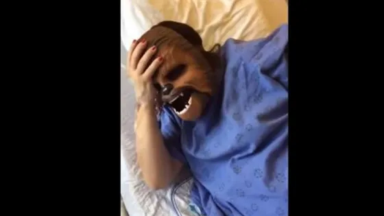 La mujer Chewbacca que dio a luz