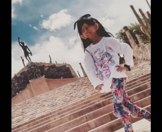 Falleció Julieta, la salteña con envejecimiento prematuro