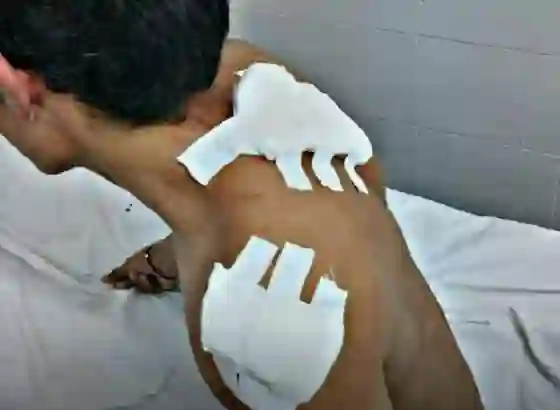 Salvador Mazza: Así quedó el joven apuñalado en el colegio por su compañero