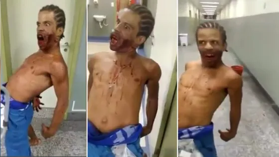 El espeluznante video de un hombre “poseído” en un hospital de Brasil